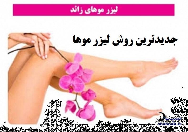 جدیدترین روش لیزر موهای زائد جدیدترین روش لیزر موهای زائد