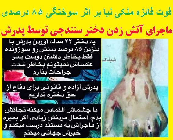 فائزه ملکی نیا کیست, دختر سنندجی که توسط پدرش سوزانده شد فائزه ملکی نیا کیست, دختر سنندجی که توسط پدرش سوزانده شد